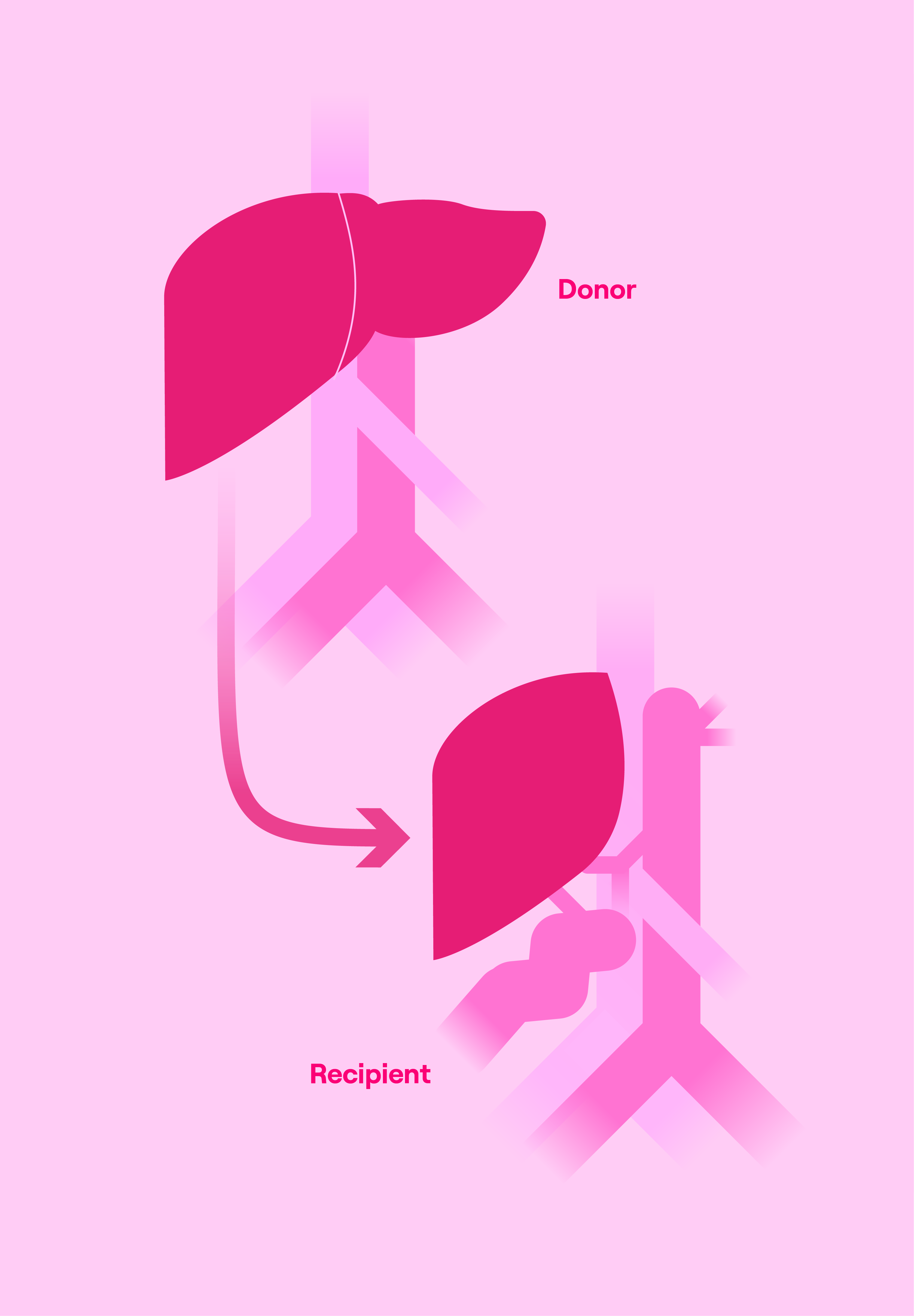 IMPACT_Illustrations_SURG_Transplant_v3